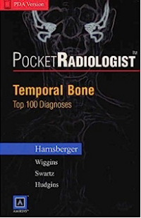 PocketRadiologist : temporal bone : top 100 diagnoses